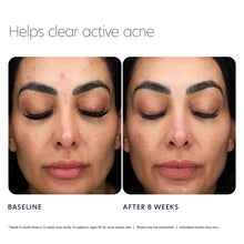 Load image into Gallery viewer, Acne Control Prebiotic Gel Cleanser