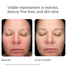 Load image into Gallery viewer, PCA Skin Triple Exfoliation Peel Pads